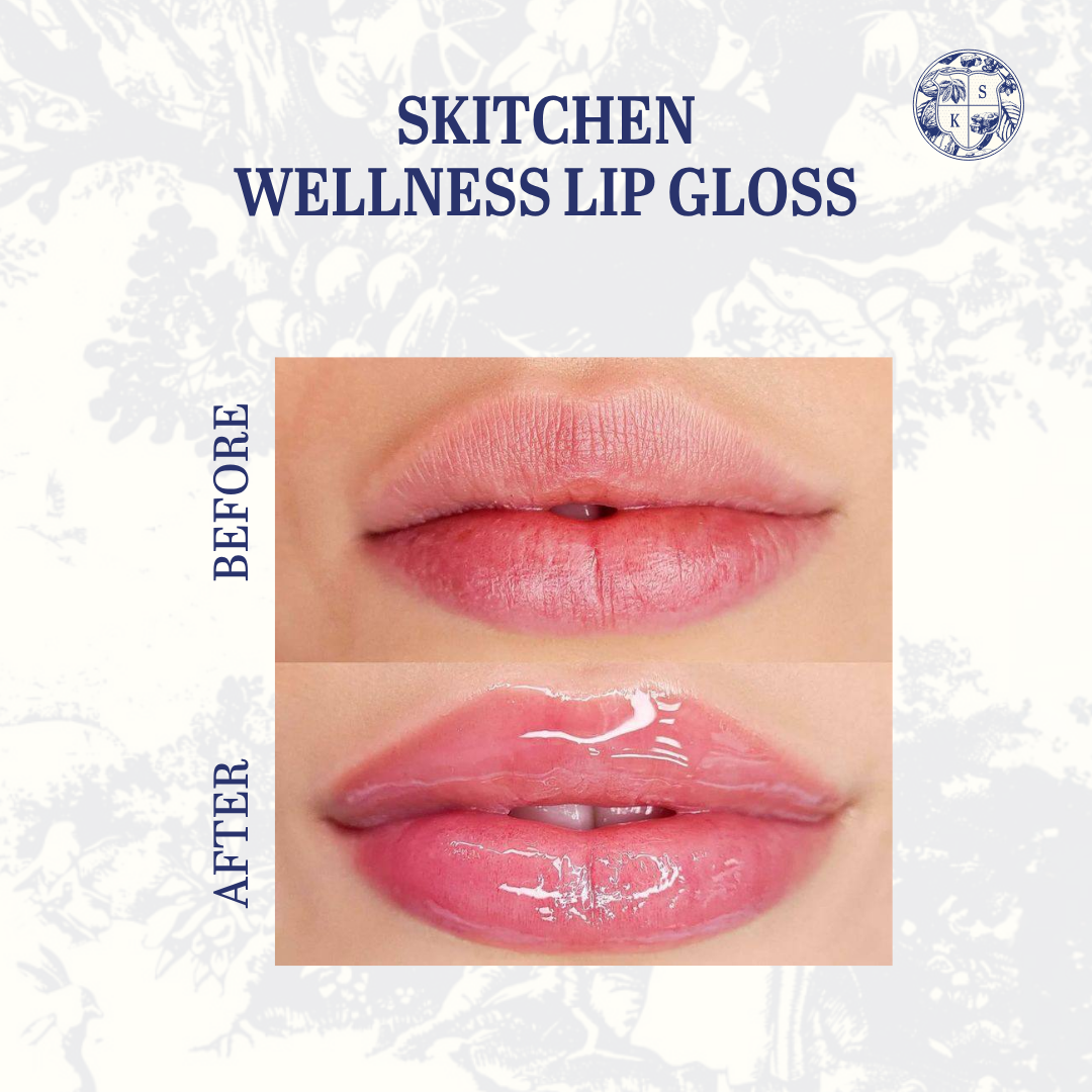 SKITCHEN Glow Box